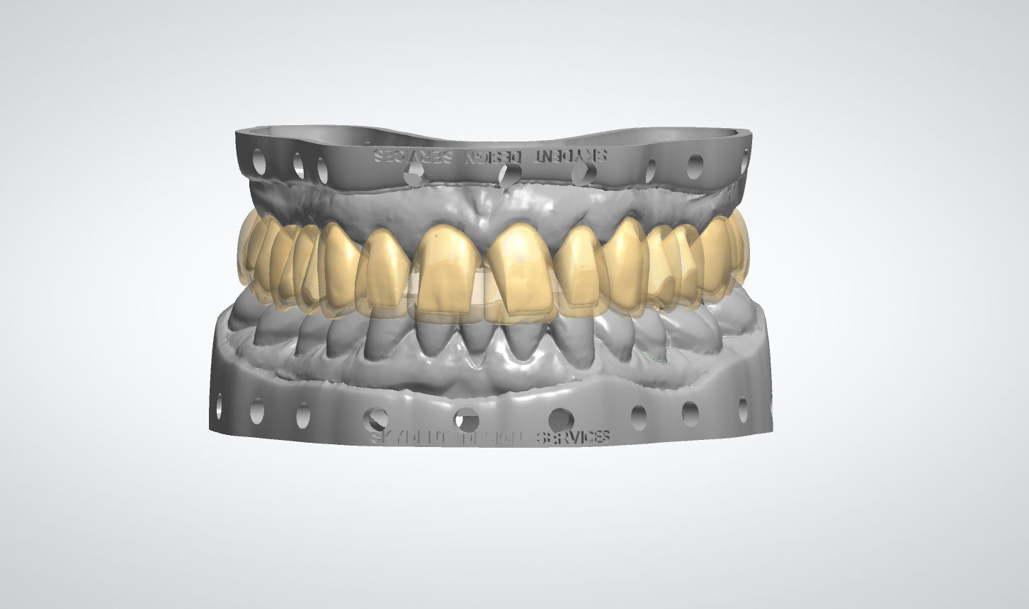 Digital Wax-Up MO+C2